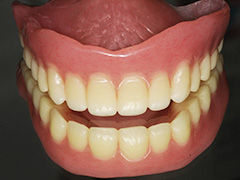 一般レジン床義歯