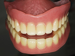 General acrylic resin base dentures
